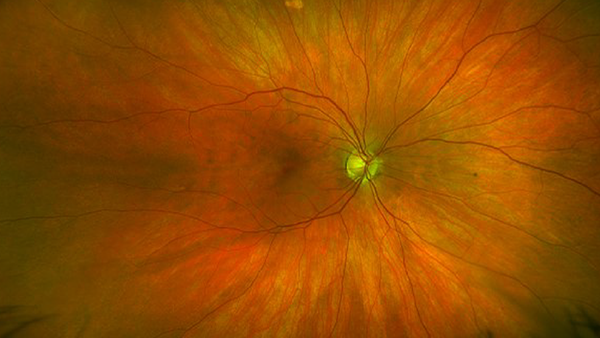 New Frontiers: The Quest for Pan-Ocular Imaging