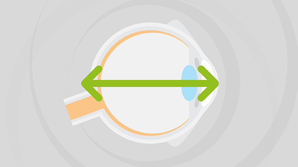 The Case for Axial Length Measurement