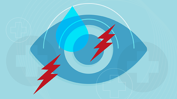 How to Set Up a Dry Eye Clinic